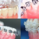 Какие проблемы решает ортодонт?