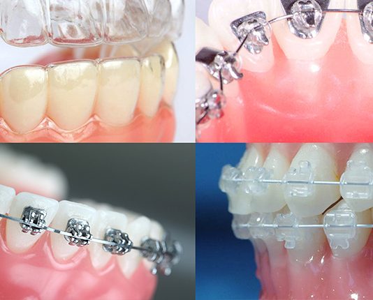 Какие проблемы решает ортодонт?