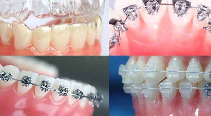 Какие проблемы решает ортодонт?