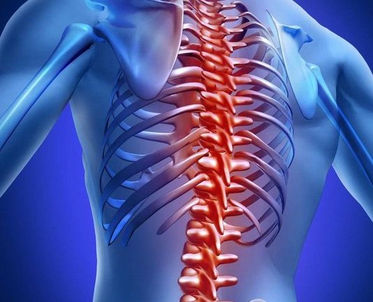 Можно ли вылечить смещение позвонков?