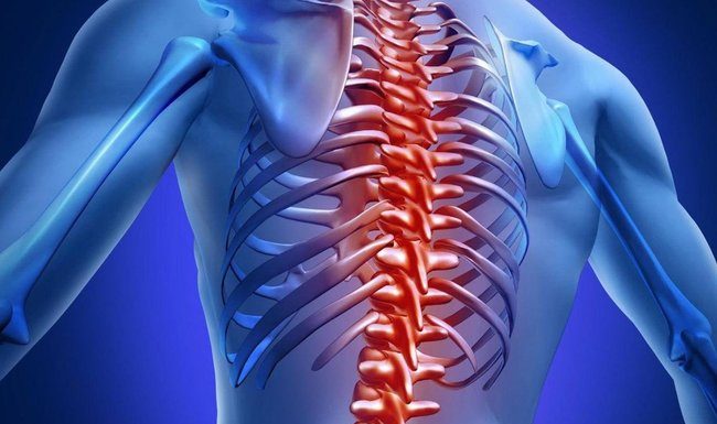 Можно ли вылечить смещение позвонков?