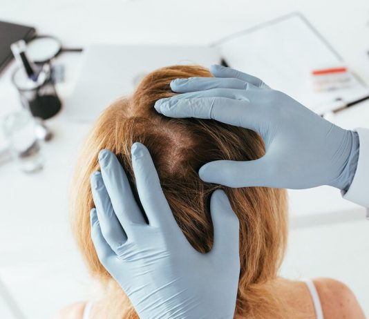 Какие заболевания лечит врач-трихолог?