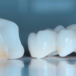 Циркониевые коронки: преимущества и недостатки
