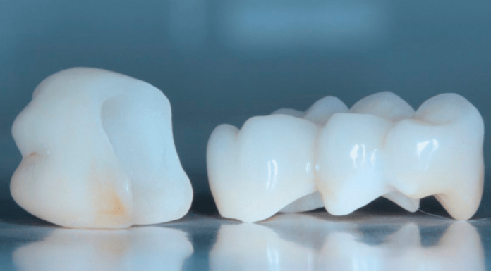 Циркониевые коронки: преимущества и недостатки