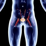 Можно ли вылечить рак предстательной железы