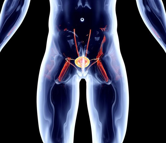 Можно ли вылечить рак предстательной железы