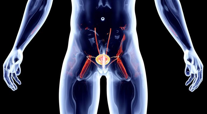 Можно ли вылечить рак предстательной железы