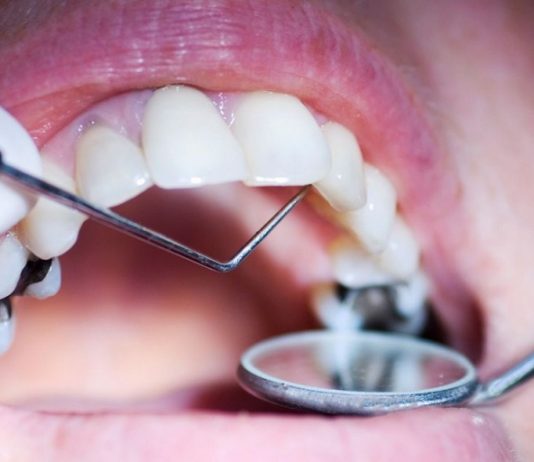 Какие есть способы лечения зубов?