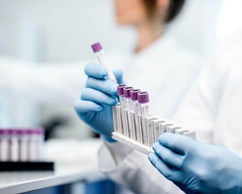 Сколько длится лечение от ЗППП?