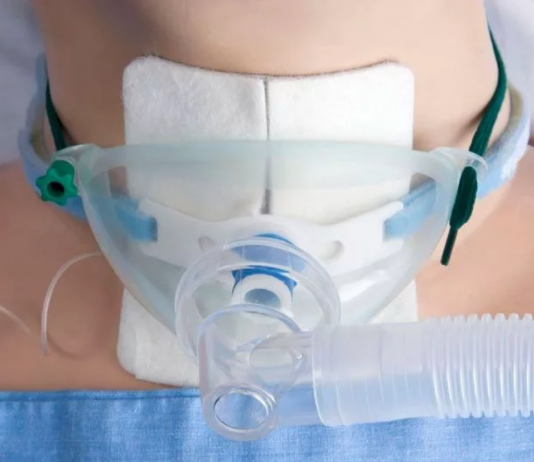 Что необходимо знать при трахеостомии