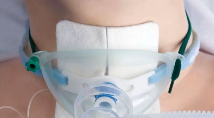 Что необходимо знать при трахеостомии