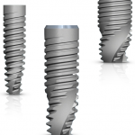 Импланты mis: разновидности, особенности, преимущества