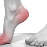 Что современная медицина говорит о болезни подагре и методах ее лечения?