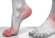 Что современная медицина говорит о болезни подагре и методах ее лечения?