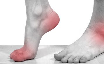 Что современная медицина говорит о болезни подагре и методах ее лечения?