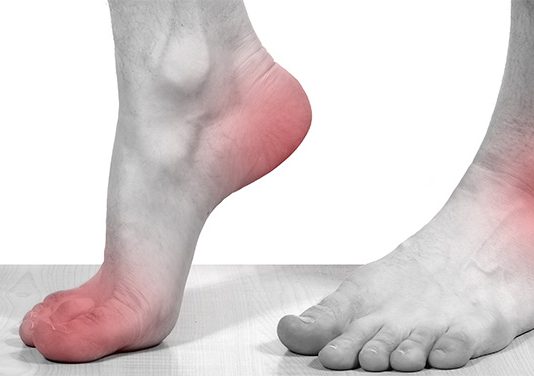 Что современная медицина говорит о болезни подагре и методах ее лечения?