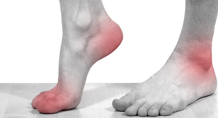 Что современная медицина говорит о болезни подагре и методах ее лечения?