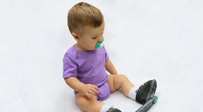 Как победить косолапость с помощью брейсов