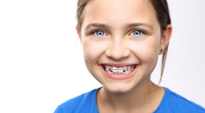 Исправление прикуса у детей: методы выравнивания
