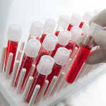 Что можно определить по биохимическому анализу крови?