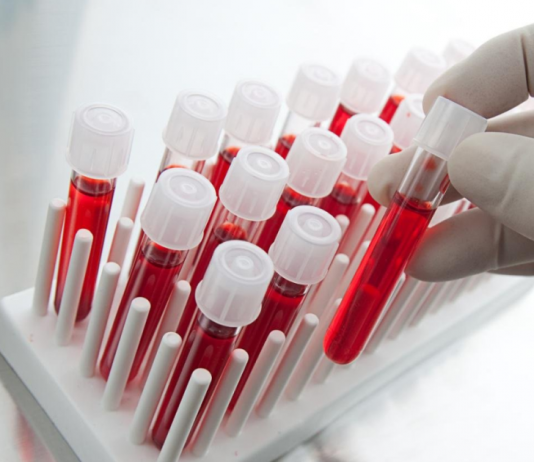 Что можно определить по биохимическому анализу крови?