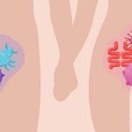 Как лечится от венерических заболеваний?