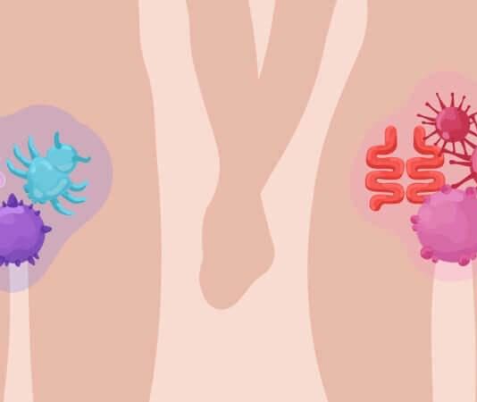 Как лечится от венерических заболеваний?