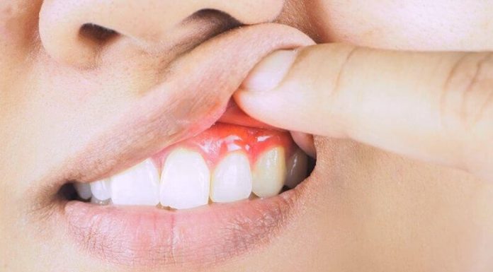 Как сейчас лечат пародонтоз?