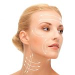 Нитевой лифтинг лица: особенности, показания