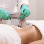 Что такое криолиполиз: показания и противопоказания