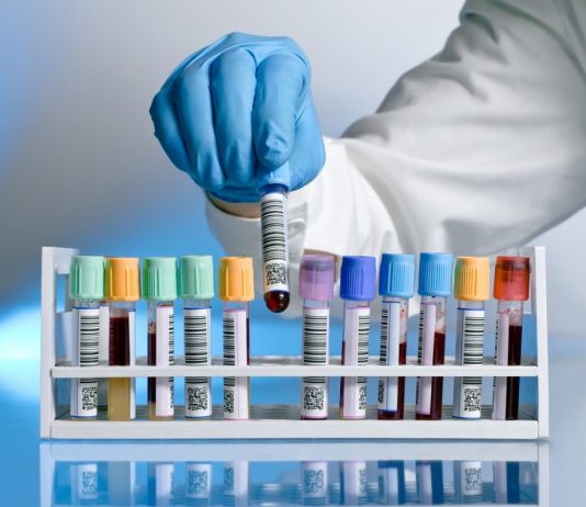 Какие бывают вакуумные пробирки?