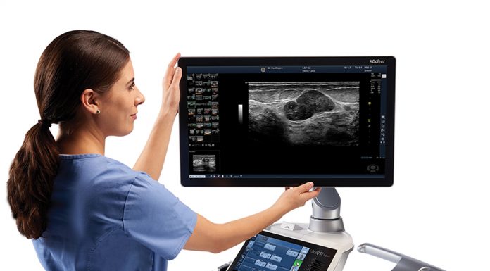 Какие бывают аппараты УЗИ