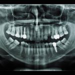 Для чего нужна диагностика зубов