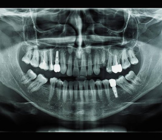 Для чего нужна диагностика зубов