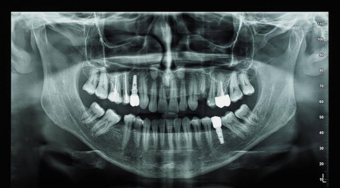 Для чего нужна диагностика зубов