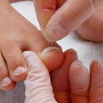 Кто такой врач подолог и какие проблемы решает