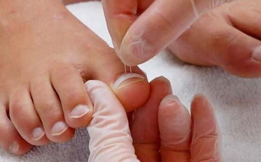 Кто такой врач подолог и какие проблемы решает