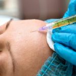 Плазмолифтинг: назначение, суть, особенности выполнения процедуры