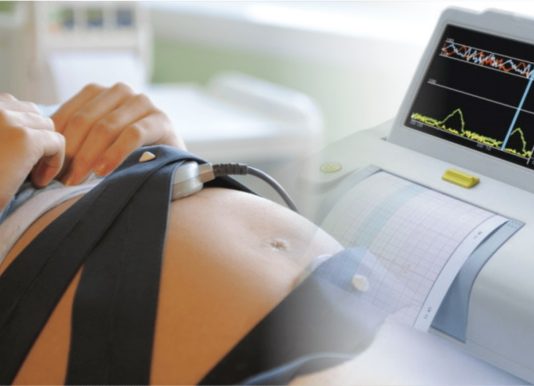 Какое должно быть КТГ плода?