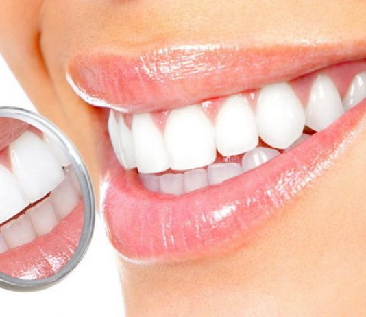 Современные методики отбеливания зубов