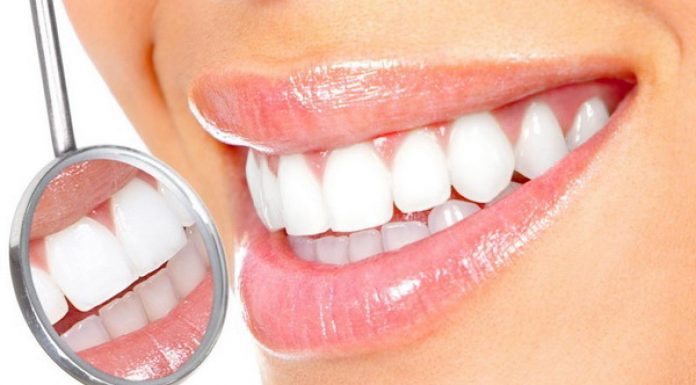 Современные методики отбеливания зубов