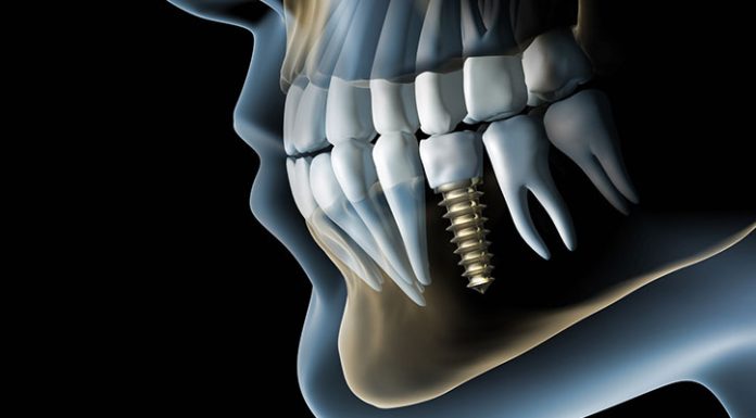Что можно увидеть на 3д снимке зубов
