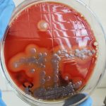 Какие инфекции показывает бак посев