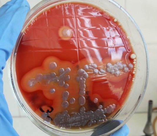 Какие инфекции показывает бак посев