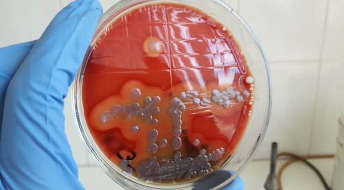 Какие инфекции показывает бак посев