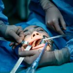 Хирургическая стоматология: сложные случаи