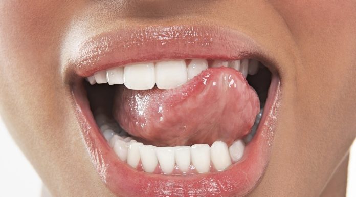 Что помогает быстро избавиться от стоматита