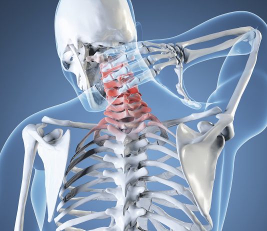Резорбция грыжи шейного отдела: эффективный метод лечения