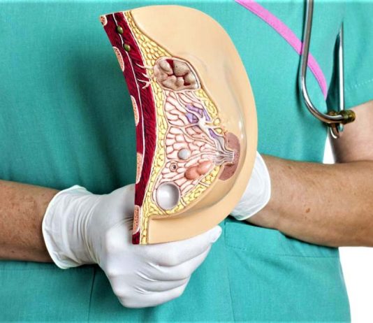 Рак молочной железы: симптомы, методы диагностики