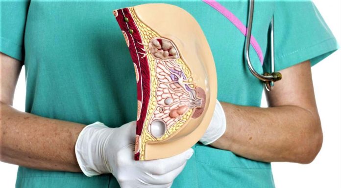 Рак молочной железы: симптомы, методы диагностики